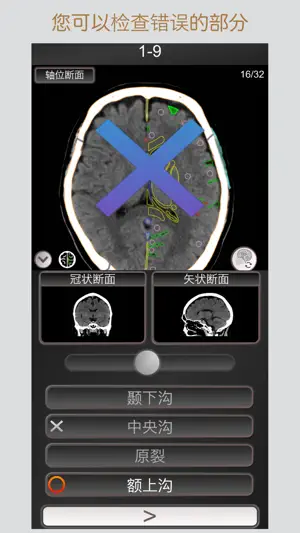 CT 护照测验 头部 / 剖面解剖/ MRI